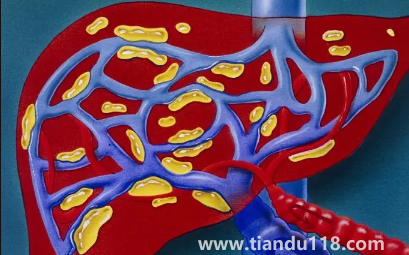 肝代謝不好吃什么調理(肝代謝不好有什么癥狀)(圖4) 肝代謝不好吃什么調理4