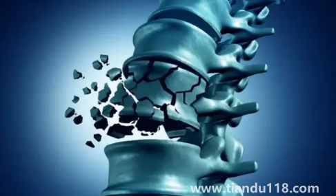 骨質(zhì)疏松癥也叫靜悄悄的流行?。ü琴|(zhì)疏松吃什么食物可以改善）